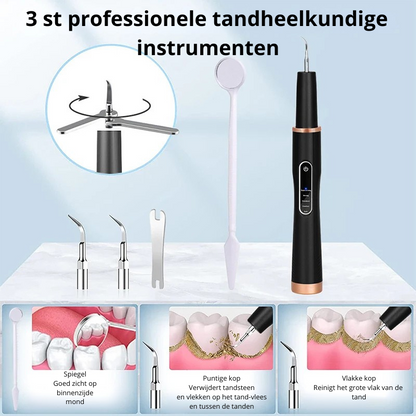 SteenVrij™ - Zeg vaarwel tegen tandsteen, hallo tegen stralen